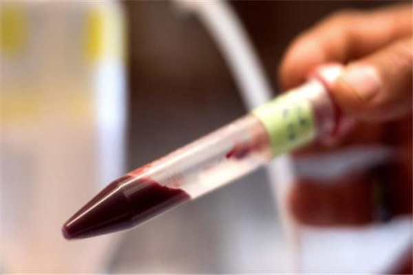 人造血液能否代替人血 人造血液的原材料是什么