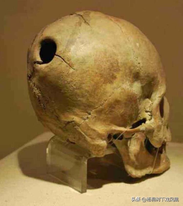 不可思议的史前考古发现脑袋上有孔是开颅手术还是吸食人脑