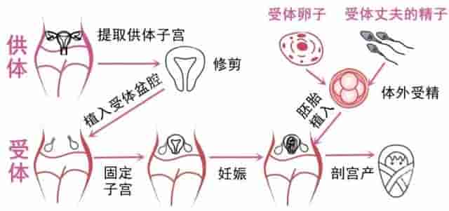 没有子宫，移植也行！上海一医院招患者，网友：男性可以吗？会有伦理问题吗？
